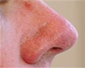 The Beauty Suite ThermaVein