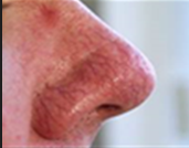 The Beauty Suite ThermaVein